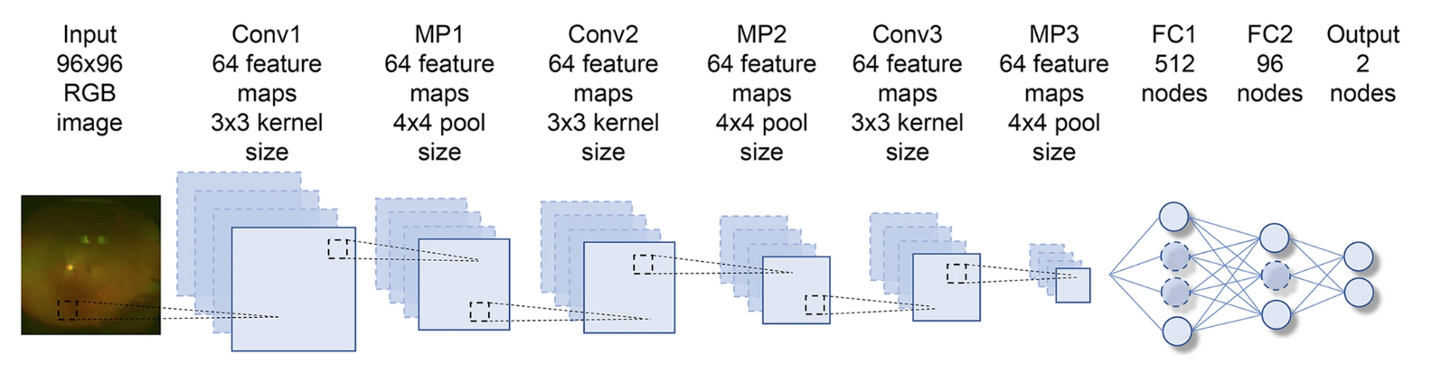 CNN architecture used. The Input is represented by the RGB 96x96 pixel image. Each of the convolutional layers (Conv1–3) is followed by an activation function layer (ReLU), pooling layers (MP1–3), and two fully connected layers (FC1, FC2).